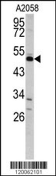 GAS7 Antibody (C-term)
