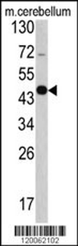 GAS7 Antibody (C-term)