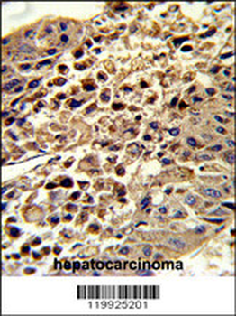 VDAC1 Antibody (Center)