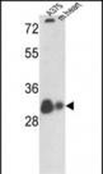 VDAC1 Antibody (N-term)