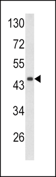DCN Antibody (Center)