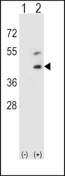 DCN Antibody (Center)