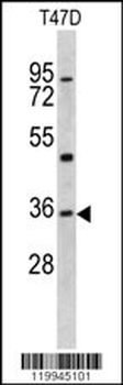 KLF6 Antibody (N-term)