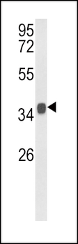 KLF6 Antibody (C-term)