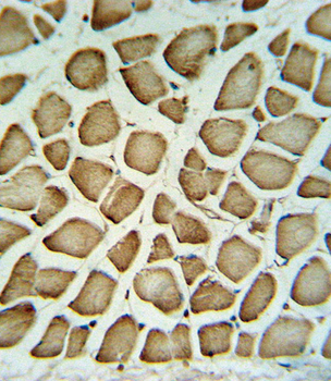 FIBG Antibody (C-term)