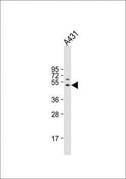 FIBG Antibody (C-term)