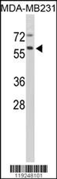 CTSF Antibody (Center D276)