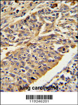 CTSE Antibody (Center)