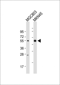 CTSE Antibody (Center)