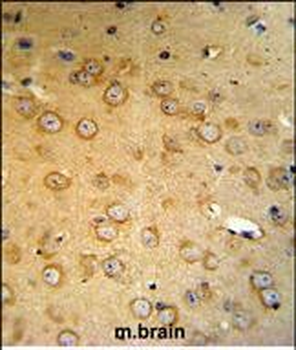 VHL Antibody (C-term)