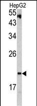 VHL Antibody (C-term)