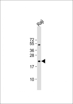 VHL Antibody (C-term)