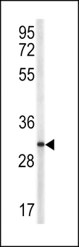 TRAP Antibody (N-term)