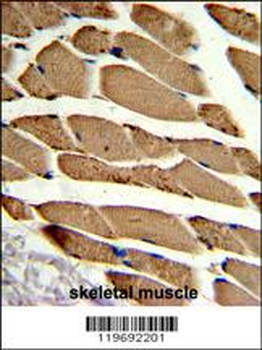 ACTR2 Antibody (Center)