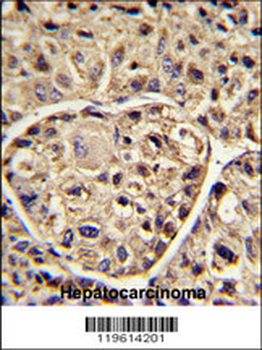 ELOVL6 Antibody (N-term)