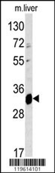 ELOVL6 Antibody (N-term)