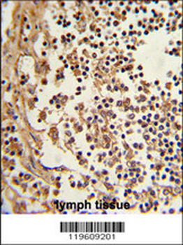 EEF1D Antibody (N-term)