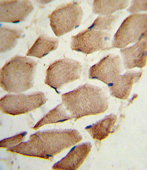 ARPC1A Antibody (C-term)