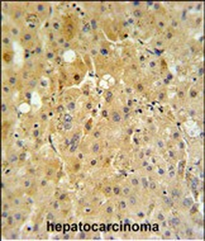 P450R Antibody (Center)