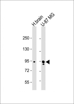 Synphilin-1 (SNCAIP) Antibody (C-term)
