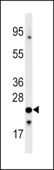FXN Antibody (C-term)