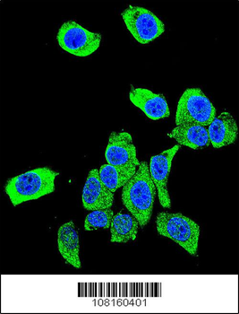 DJ-1 Antibody (N-term)