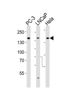 Tuberin (TSC2) Antibody (S1798)