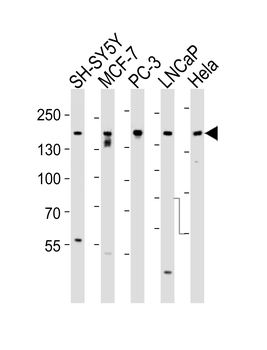 Tuberin (TSC2) Antibody (S1798)
