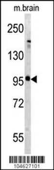 Metabotropic Glutamate Receptor 5 (GPRC1E) Antibody (C-term T1003)