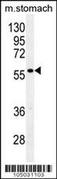 Glypican 3 (GPC3) Antibody (N-term)