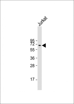 Glypican 3 (GPC3) Antibody (N-term)