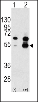 VEGF1 Antibody (N-term)