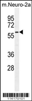 Parp6 Antibody (C-term 503)