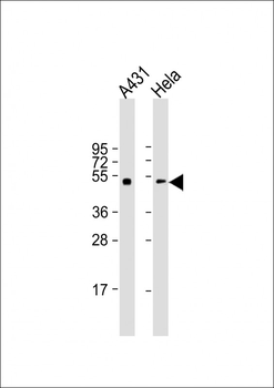 p53 Antibody (S15)