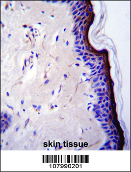 p53 Antibody (T55)