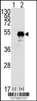 p53 Antibody (T55)