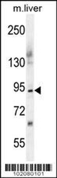 ST14 Antibody (C-term)