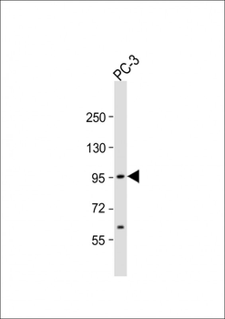 ST14 Antibody (C-term)