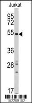 SMYD5 (RAI15) Antibody (C-term)