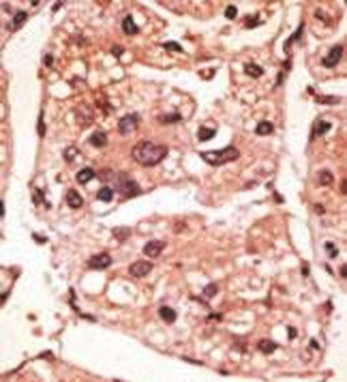 Presenilin 1 (PSEN1) Antibody (C-term)