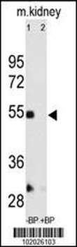 MMP12 Antibody (C-term)