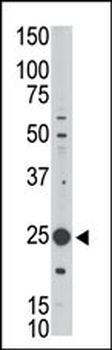 MAGEH1 Antibody (C-term)