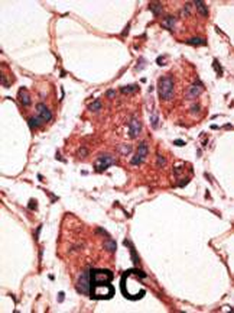 MAGEA9 Antibody (Center)