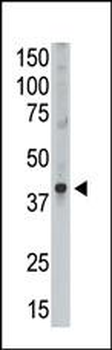 MAGEA9 Antibody (Center)