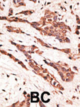EDG4 Antibody (N-term)