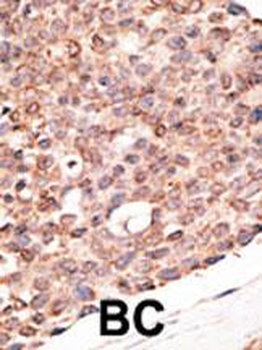 Cry2 Antibody (C-term)