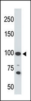 ACE2 (SARS Receptor) Antibody (C-term)