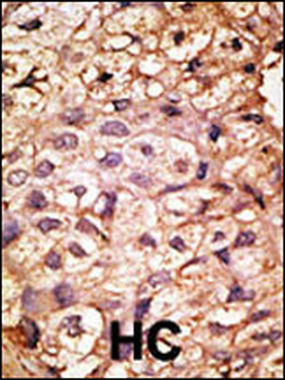 ACE2 (SARS Receptor) Antibody (N-term)