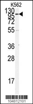 ACE2 (SARS Receptor) Antibody (N-term)