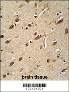 MYLK4 Antibody (C-term)